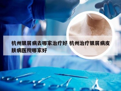 杭州银屑病去哪家治疗好 杭州治疗银屑病皮肤病医院哪家好