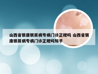 山西省银康银屑病专病门诊正规吗 山西省银康银屑病专病门诊正规吗知乎