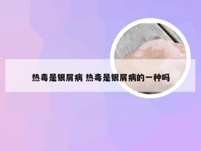 热毒是银屑病 热毒是银屑病的一种吗