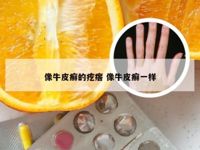 像牛皮癣的疙瘩 像牛皮癣一样