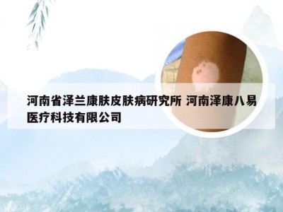河南省泽兰康肤皮肤病研究所 河南泽康八易医疗科技有限公司