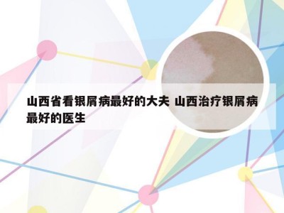 山西省看银屑病最好的大夫 山西治疗银屑病最好的医生