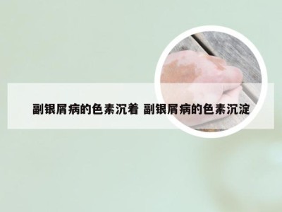 副银屑病的色素沉着 副银屑病的色素沉淀