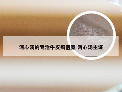 泻心汤的专治牛皮癣医案 泻心汤主证