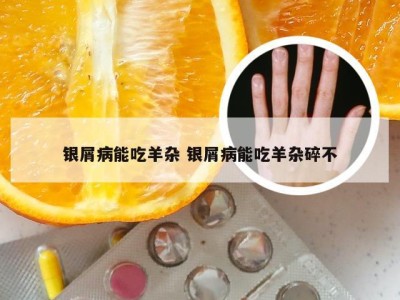 银屑病能吃羊杂 银屑病能吃羊杂碎不