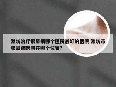潍坊治疗银屑病哪个医院最好的医院 潍坊市银屑病医院在哪个位置?
