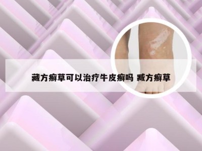 藏方癣草可以治疗牛皮癣吗 臧方癣草