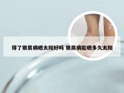 得了银屑病晒太阳好吗 银屑病能晒多久太阳