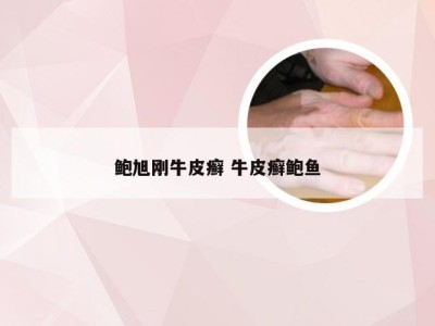 鲍旭刚牛皮癣 牛皮癣鲍鱼