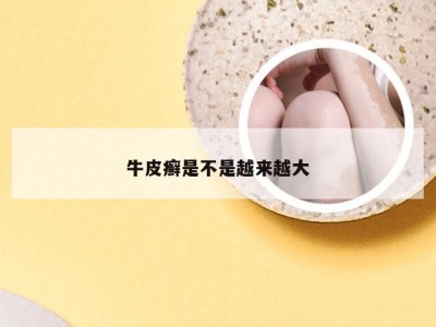 牛皮癣是不是越来越大