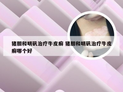 猪胆和明矾治疗牛皮癣 猪胆和明矾治疗牛皮癣哪个好