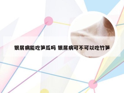 银屑病能吃笋瓜吗 银屑病可不可以吃竹笋