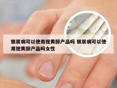 银屑病可以使用视黄醇产品吗 银屑病可以使用视黄醇产品吗女性