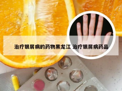 治疗银屑病的药物黑龙江 治疗银屑病药品