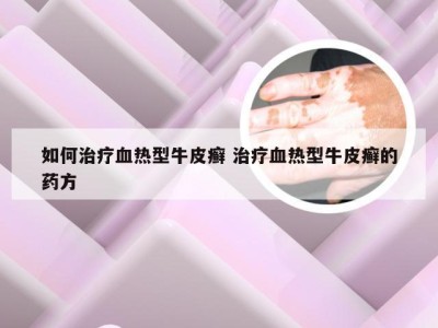 如何治疗血热型牛皮癣 治疗血热型牛皮癣的药方