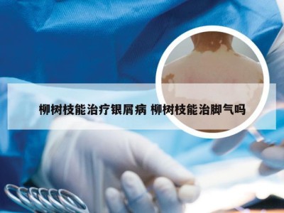 柳树枝能治疗银屑病 柳树枝能治脚气吗