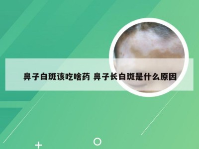 鼻子白斑该吃啥药 鼻子长白斑是什么原因