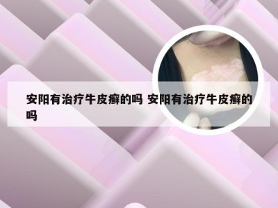 安阳有治疗牛皮癣的吗 安阳有治疗牛皮癣的吗