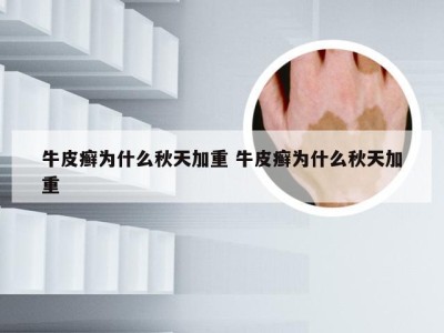 牛皮癣为什么秋天加重 牛皮癣为什么秋天加重