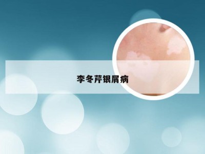 李冬芹银屑病
