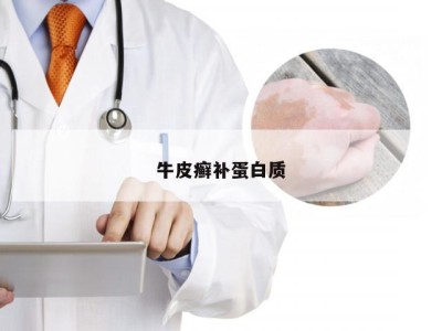 牛皮癣补蛋白质
