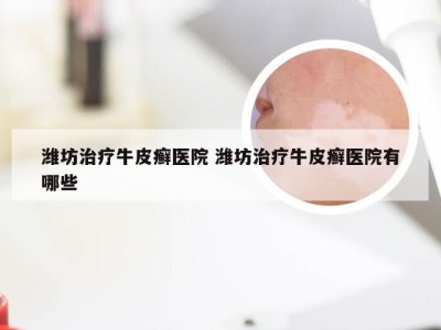 潍坊治疗牛皮癣医院 潍坊治疗牛皮癣医院有哪些