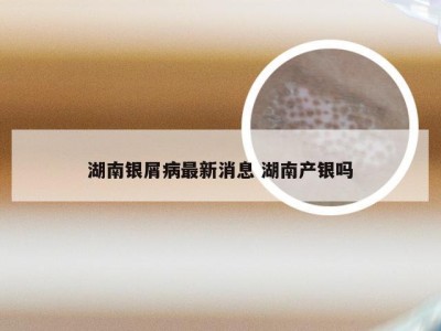 湖南银屑病最新消息 湖南产银吗