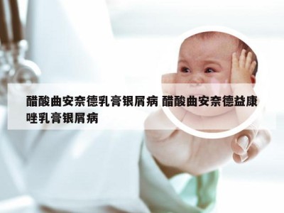 醋酸曲安奈德乳膏银屑病 醋酸曲安奈德益康唑乳膏银屑病