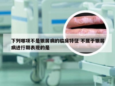 下列哪项不是银屑病的临床特征 不属于银屑病进行期表现的是