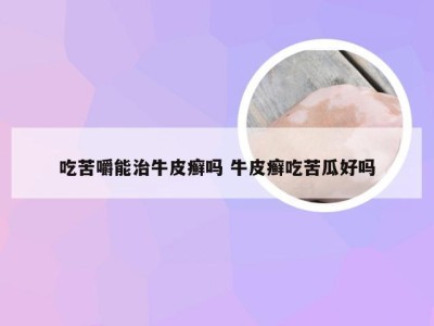 吃苦嚼能治牛皮癣吗 牛皮癣吃苦瓜好吗