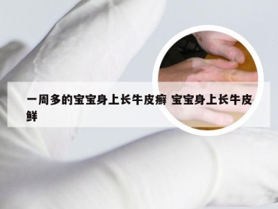 一周多的宝宝身上长牛皮癣 宝宝身上长牛皮鲜