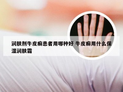 润肤剂牛皮癣患者用哪种好 牛皮癣用什么保湿润肤霜