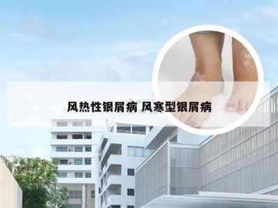 风热性银屑病 风寒型银屑病