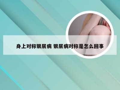 身上对称银屑病 银屑病对称是怎么回事