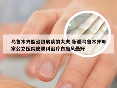 乌鲁木齐能治银屑病的大夫 新疆乌鲁木齐哪家公立医院皮肤科治疗白癜风最好