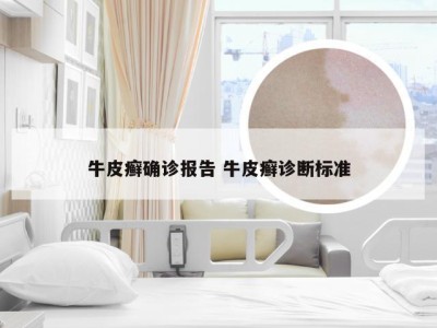 牛皮癣确诊报告 牛皮癣诊断标准