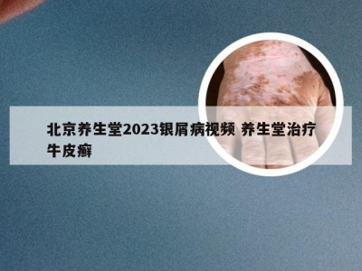 北京养生堂2023银屑病视频 养生堂治疗牛皮癣