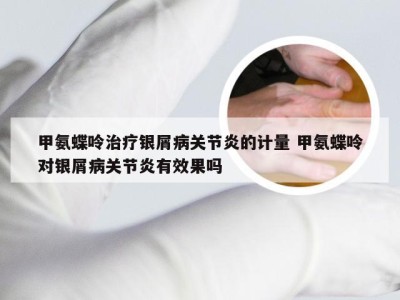 甲氨蝶呤治疗银屑病关节炎的计量 甲氨蝶呤对银屑病关节炎有效果吗