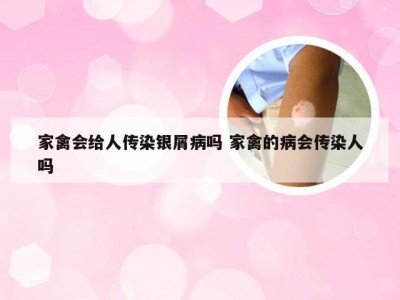 家禽会给人传染银屑病吗 家禽的病会传染人吗