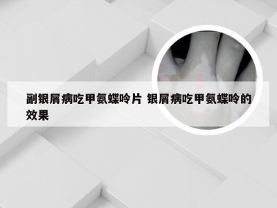 副银屑病吃甲氨蝶呤片 银屑病吃甲氨蝶呤的效果