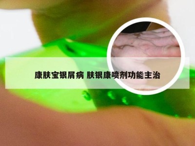 康肤宝银屑病 肤银康喷剂功能主治