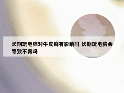 长期玩电脑对牛皮癣有影响吗 长期玩电脑会导致不育吗