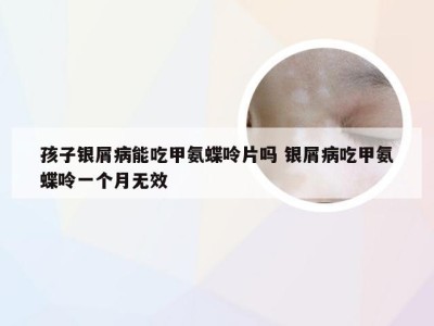 孩子银屑病能吃甲氨蝶呤片吗 银屑病吃甲氨蝶呤一个月无效