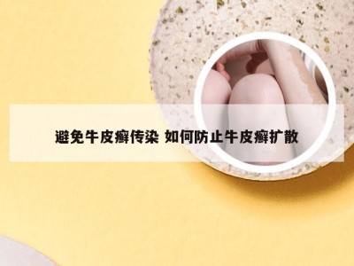 避免牛皮癣传染 如何防止牛皮癣扩散