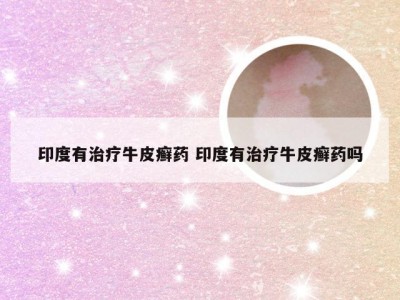 印度有治疗牛皮癣药 印度有治疗牛皮癣药吗