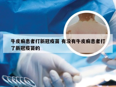 牛皮癣患者打新冠疫苗 有没有牛皮癣患者打了新冠疫苗的