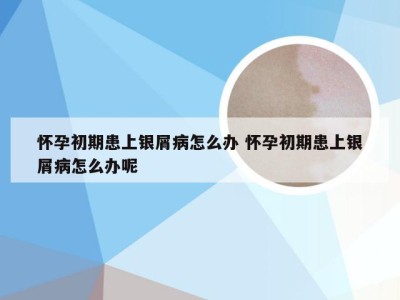 怀孕初期患上银屑病怎么办 怀孕初期患上银屑病怎么办呢