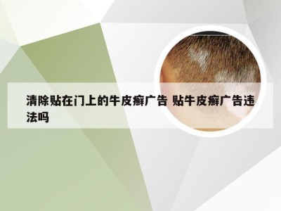 清除贴在门上的牛皮癣广告 贴牛皮癣广告违法吗