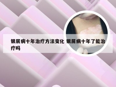银屑病十年治疗方法变化 银屑病十年了能治疗吗