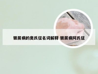 银屑病的奥氏征名词解释 银屑病阿氏征